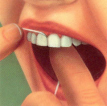Очистка промежутков между зубами с помощью зубных нитей